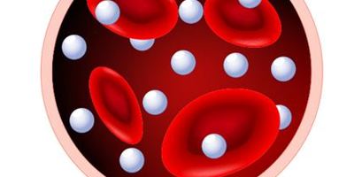 【孕妇燕窝】关于孕妇血糖值正常范围标准